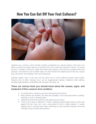 How You Can Get Off Your Feet Calluses