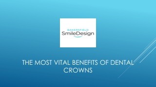 The Most Vital Benefits of Dental Crowns