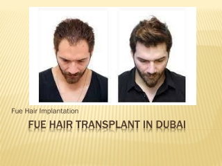 Fue Hair Transplant In Dubai