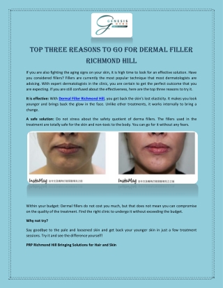 Top Three Reasons to Go for Dermal Filler Richmond Hill