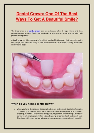 Dental Crown One Of The Best Ways To Get A Beautiful Smile