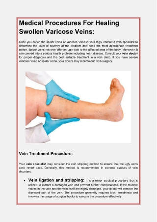 Medical Procedures For Healing Swollen Varicose Veins