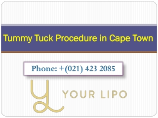 Tummy Tuck Procedure in Cape Town