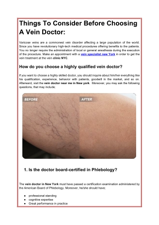 Things To Consider Before Choosing A Vein Doctor_