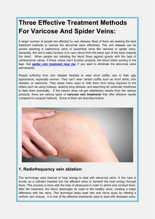 Three Effective Treatment Methods For Varicose And Spider Veins