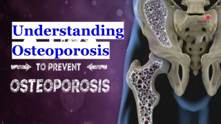 Understanding Osteoporosis