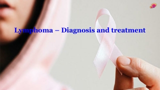 Lymphoma – Diagnosis and treatment