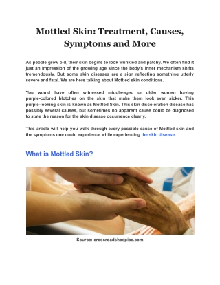 Mottled Skin: Treatment, Causes, Symptoms and More