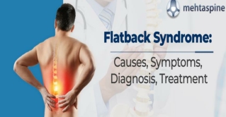 Flatback Syndrome: Causes, Symptoms, Diagnosis and Treatment | Mehta Spine