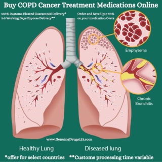 Buy COPD Treatment Medications (Generic & Brand) Online