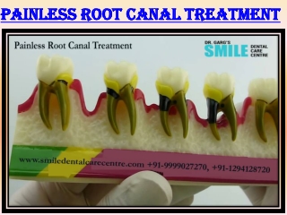 Painless Root Canal Treatment in Faridabad Delhi NCR