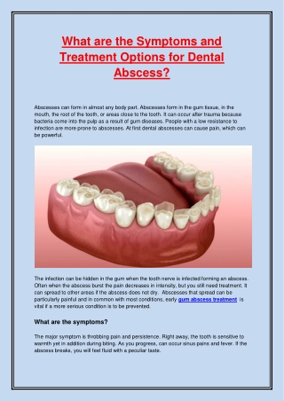 What are the Symptoms and Treatment Options for Dental Abscess