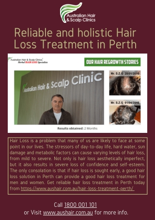 Reliable and holistic Hair Loss Treatment in Perth