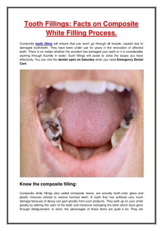 Tooth Fillings Facts on Composite White Filling Process