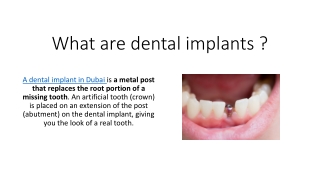 What are dental implants