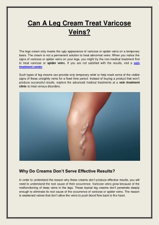 Can A Leg Cream Treat Varicose Veins