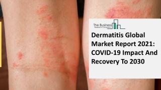 Dermatitis Drugs Market Analysis And Forecast Report 2030