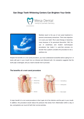 San Diego Teeth Whitening Centers Can Brighten Your Smile