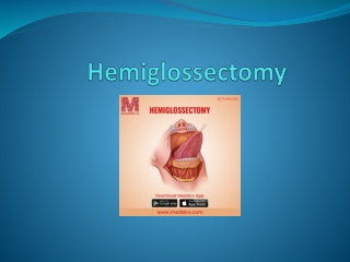 Hemiglossectomy