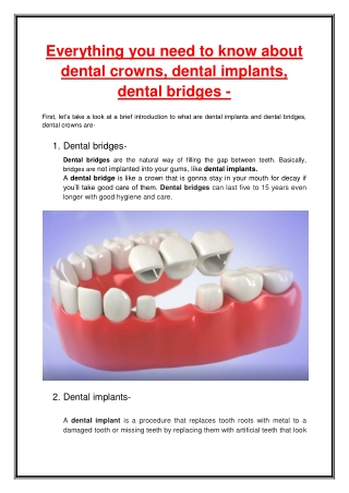 Everything you need to know about dental crowns, dental implants, dental bridges