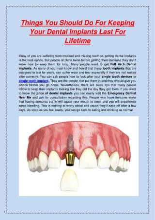 Things You Should Do For Keeping Your Dental Implants Last For Lifetime