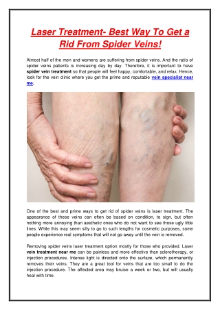 Laser Treatment- Best Way To Get a Rid From Spider Veins