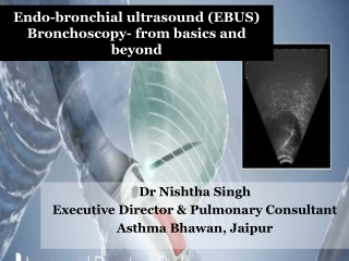 EBUS Treatment Details - Dr. Nishtha Singh