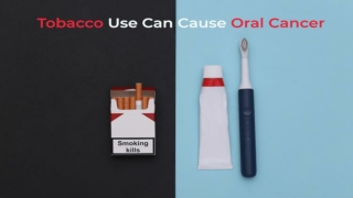 TOBACCO USE CAN CAUSE ORAL CANCER!