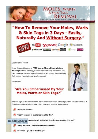 Moles, Warts & Skin Tags Removal