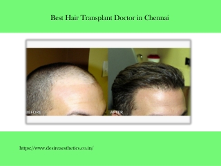 Best hair transplant doctor in Chennai