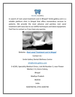 Root Canal Treatment Cost In Bhopal Smile-gallery