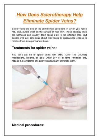 How Does Sclerotherapy Help Eliminate Spider Veins