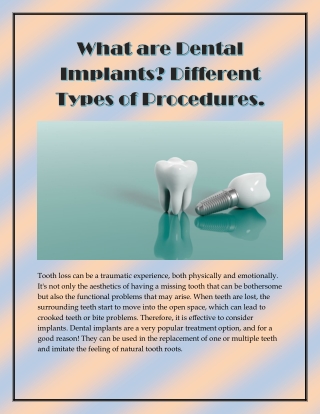 What are Dental Implants? Different Types of Procedures.