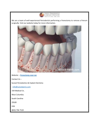 Frenectomy Near Me  Columbiascperiodontist.com