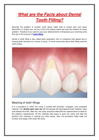 What are the Facts about Dental Tooth Filling
