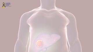 Liver Cancer Treatment Clinic in Mumbai