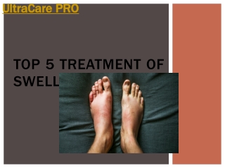 top 5 Treatment of Swelling at Home