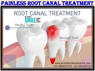 Painless Root Canal Treatment in Faridabad Visit to Get