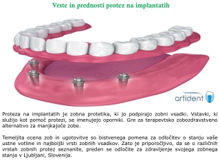 Vrste in prednosti protez na implantatih