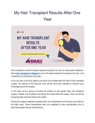 My Hair Transplant Results After One Year