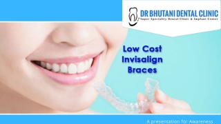 Invisalign cost in delhi | Clear aligners cost in india | invisalign braces cost