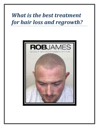 What is the best treatment for hair loss and regrowth