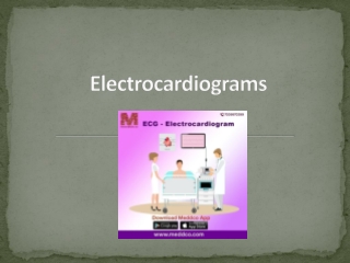 Electrocardiograms