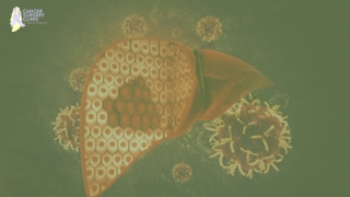 The Best Liver Cancer Treatment in Mumbai