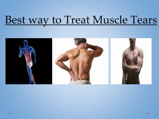 Best way to Treat Muscle Tears