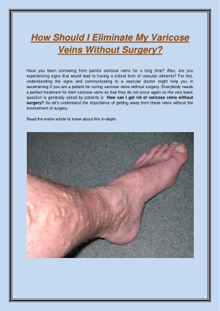 How Should I Eliminate My Varicose Veins Without Surgery