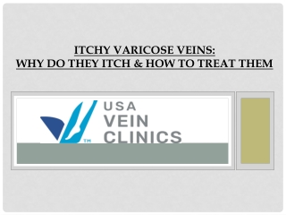 Itchy Varicose Veins - Why Do They Itch & How to Treat Them