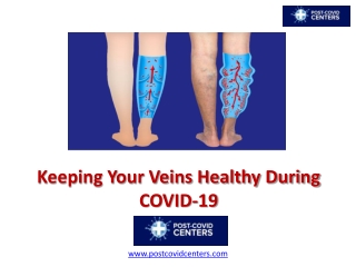 Keeping Your Veins Healthy During COVID-19