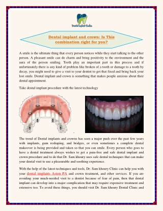 Dental implant and crown Is This combination right for you