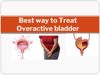 Best way to Treat Overactive bladder (1)